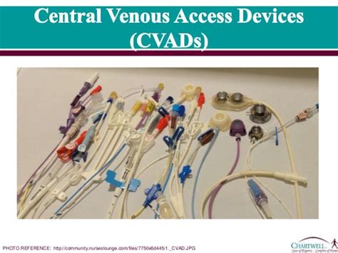 2 Central Venous Access Devices Cvads