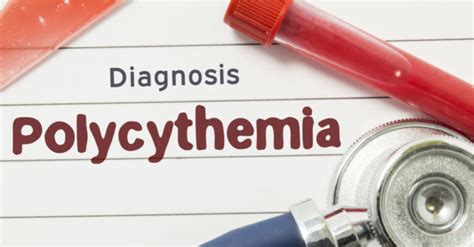 The Causes Symptoms And Treatments Of Polycythemia Vera New York Maze