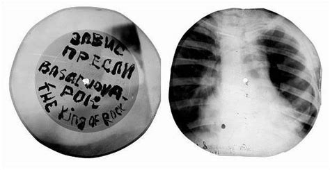 Rib And Bones When Soviet X Rays Became Bootleg Records Of Forbidden
