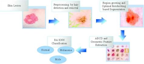 Multi Class Skin Lesions Classification System Using Probability Map