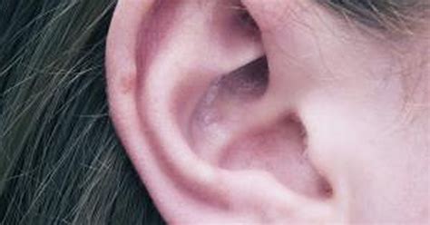 Dry Skin On The Outer Ear Livestrongcom