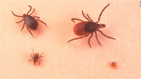 Tick Bites 2 Sickened Newborns Could Signal Increase In Infections Cnn