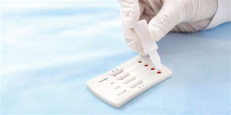 Over The Counter Std Test Kits Are Affordable And Effective