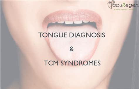 Tongue Diagnosis And Tcm Syndromes Acuregen Academy By Amanda Shayle