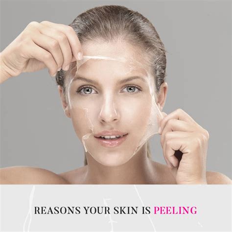 Nulook Medspa Reasons Your Skin Could Be Peeling