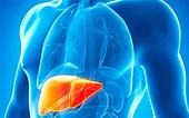 Urinary biomarkers for early liver cancer detection | The Guardian ...