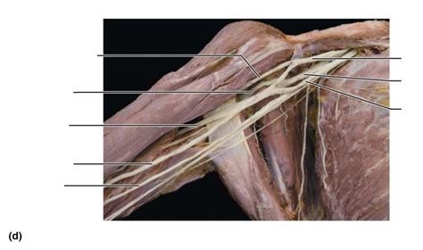 Cadaver Brachial Plexus Diagram Quizlet