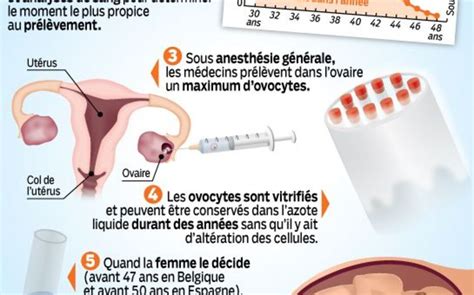 Congélation Des Ovocytes Les Gynécologues Disent Oui Le Parisien