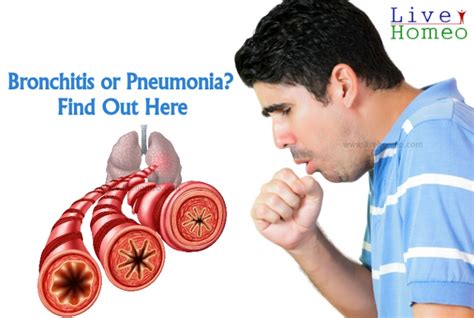 How To Identify Bronchitis Or Pneumonia Live Homeo