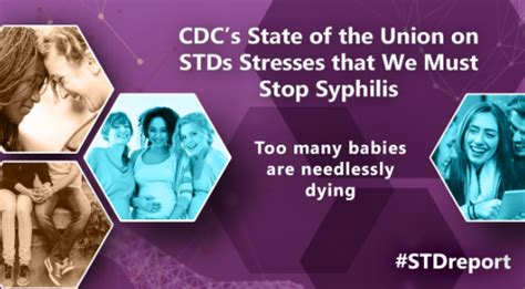 congenital syphilis us reports most cases since 1995 outbreak news today
