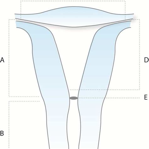 Pdf Assessment Of Uterine Cavity Size And Shape A Systematic Review Addressing Relevance To