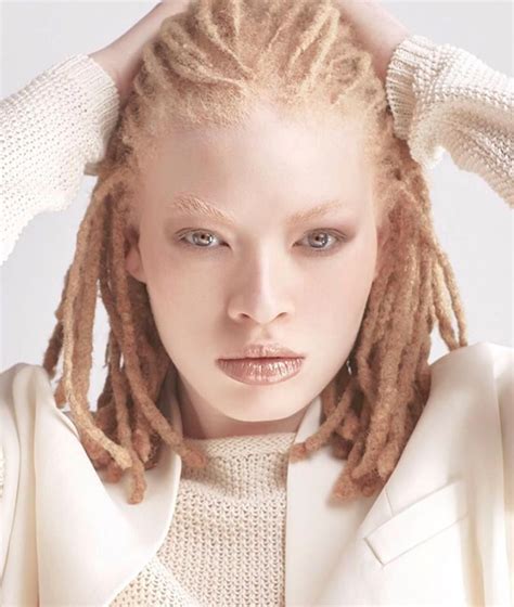 Pin By Bryan Crite On B E A U T Y Albino Model Albino Girl