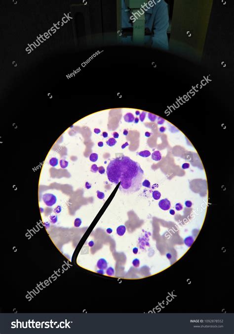 Megakaryocyte Series Bone Marrow Stock Photo 1092878552 Shutterstock