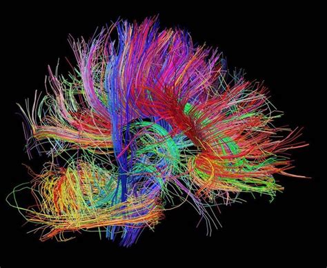 A Big Brainstorm Is On The Horizon In Neuroscience The Globe And Mail