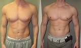 Gynecomastia Causes and Treatment For Bodybuilder | Entrepreneurs Break