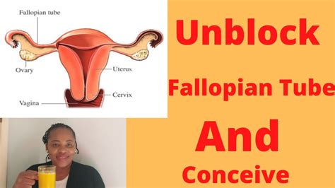 HOW TO UNBLOCK FALLOPIAN TUBES NATURALLY CONCEIVE FAST YouTube