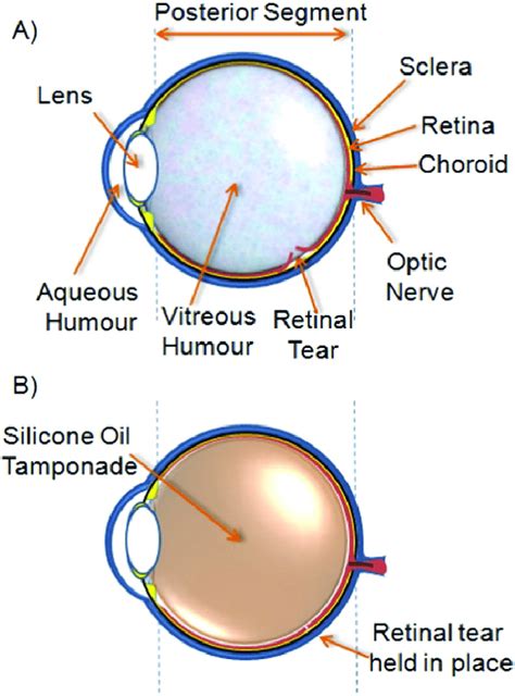 Schematic Cross Section Of The A Human Eye Showing A The Formation Of
