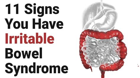 Signs You Have Irritable Bowel Syndrome