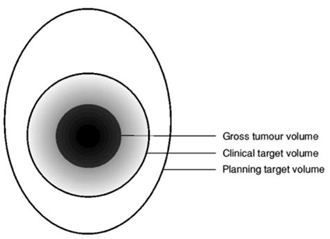 Gross Tumor Volume Gtv Ars Neurochirurgica