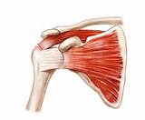 Rotator Cuff Tear Images