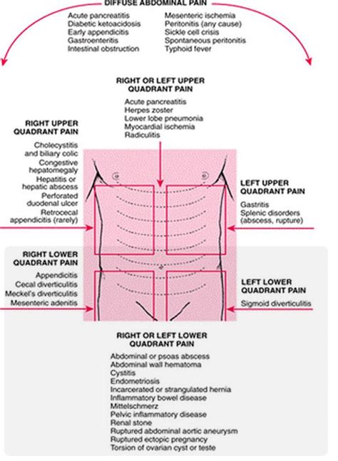 32 Best Abdominal Pain Images On Pinterest Health Tips Home Remedies