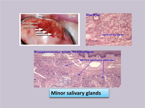 Ppt Saliva Composition And Functions Powerpoint Presentation Free