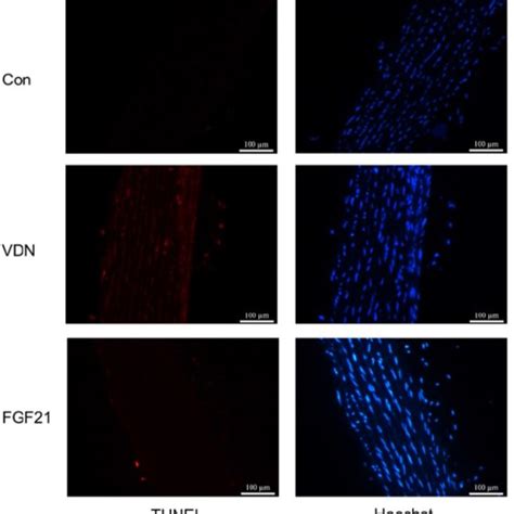 the apoptosis level of vascular smooth muscle cells vsmcs in rat download scientific diagram