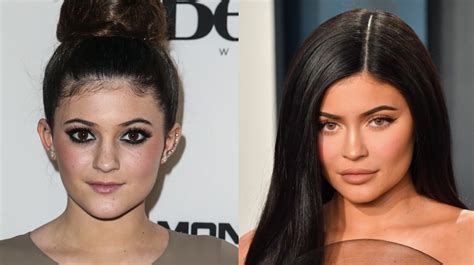 Artista muestra cómo sería actualmente el rostro de Kylie Jenner sin