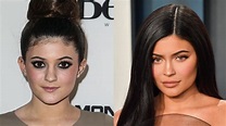 Artista muestra cómo sería actualmente el rostro de Kylie Jenner sin ...