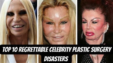 Top 10 Weird Celebrity Plastic Surgery Disasters Youtube