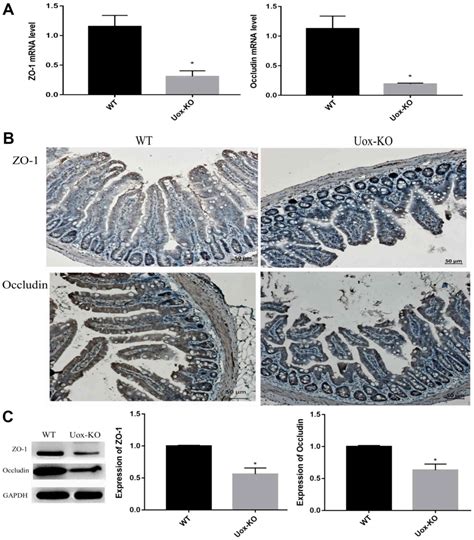 Impaired Intestinal Barrier Function In A Mouse Model Of Hyperuricemia