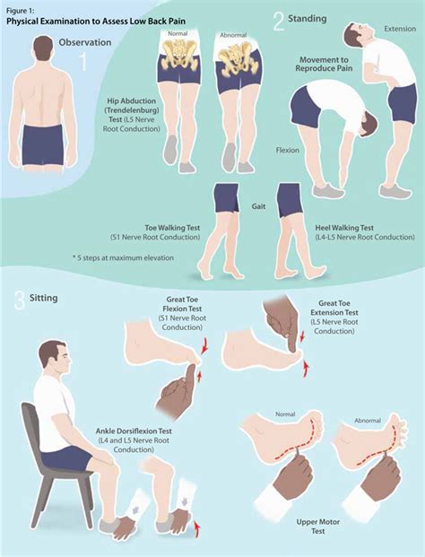 Physical Examination To Assess Low Back Pain