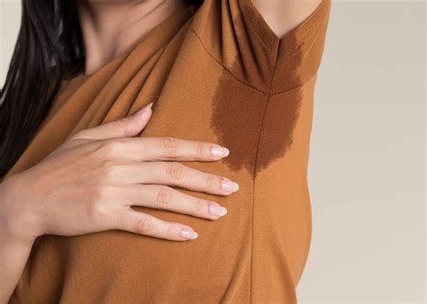 Treatments For Excessive Underarm Sweating R Clinic