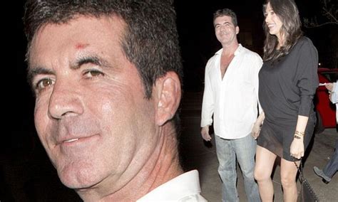 Simon Cowell Sports Mystery Forehead Cut As He Dines With Pregnant