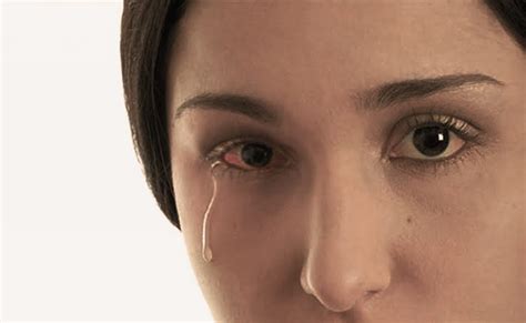 Eyes Burning Problem Douse The Fire Know The Home Remedy Healthnews24seven
