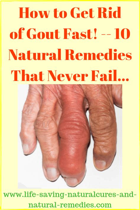 Gout is a complicated medical condition that usually affects the feet. 10 Home Remedies for Gout That Give Fast Relief!