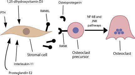 Pathophysiology Of Multiple Myeloma Bone Disease Hematology Oncology Clinics