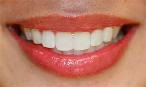 Bellevue Dentist Visits May Detect Early Tongue Disease