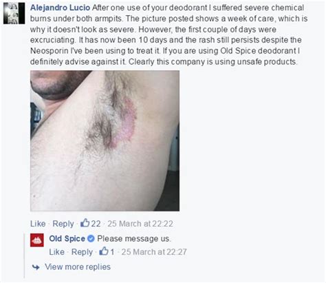 Old Spice Is Being Sued For 5 Million Because Their Deodorant Is Burning People S Skin