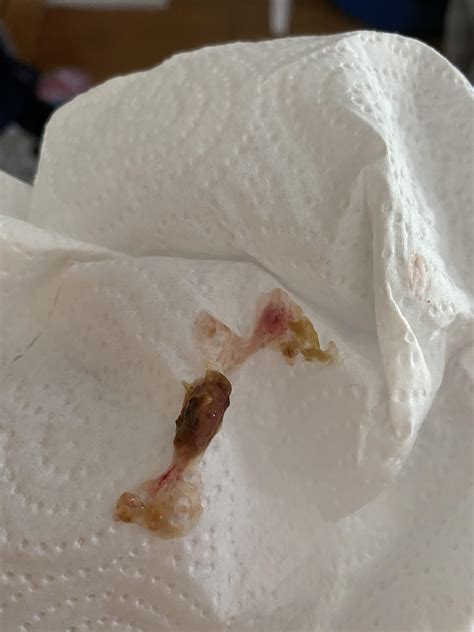 Found Bloody Mucus In Dog Stool Does Not Have Much Of An Appetite