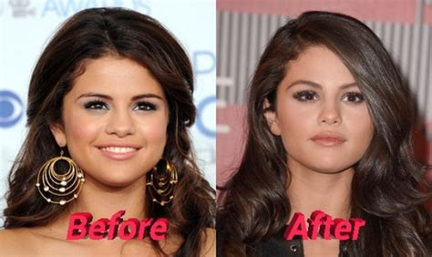 selena gomez plastic surgery or special make up really