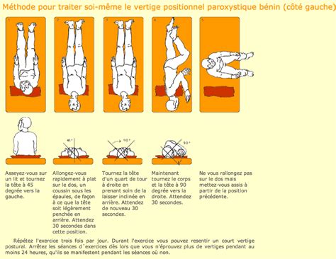 Epley Maneuver Instructions Left