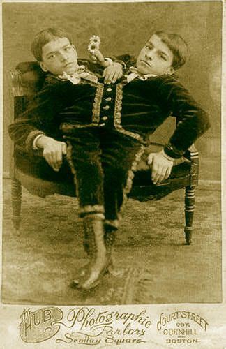 16 Odd Facts About The Tocci Brothers Famous Conjoined Twins Who Retired At 20 Human Oddities