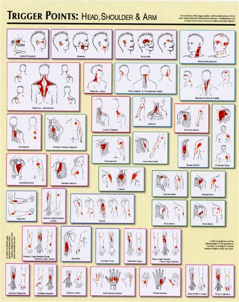 trigger point poster set clinical charts and supplies