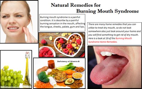 Natural Remedies For Burning Mouth Syndrome And Self Care Routine Herbs Solutions By Nature Blog