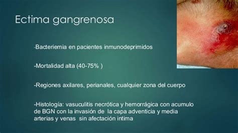Infecciones Por Pseudomona Aeruginosa