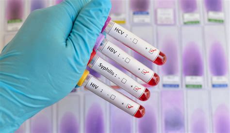 Hiv Testing Results And Accuracy