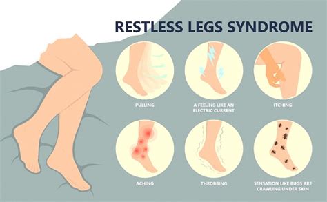 Restless Leg Syndrome And Its Relation To Varicose Veins Vein Doctors Sydney