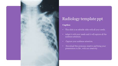 Radiology Powerpoint Template