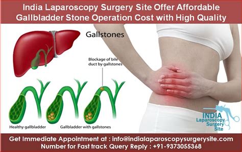 What Helps Gallbladder Pain Cares Healthy